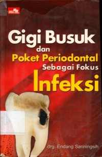 Gigi busuk dan poket periodontal sebagai fokus infeksi